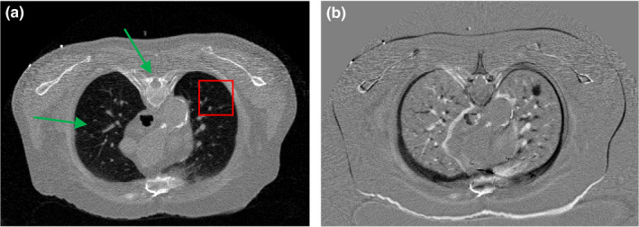 Figure 12