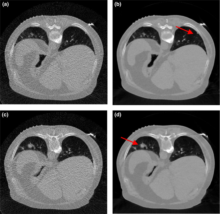 Figure 18