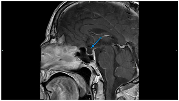 Figure 4.