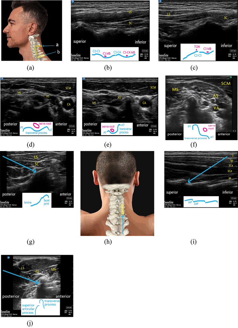 Figure 3.