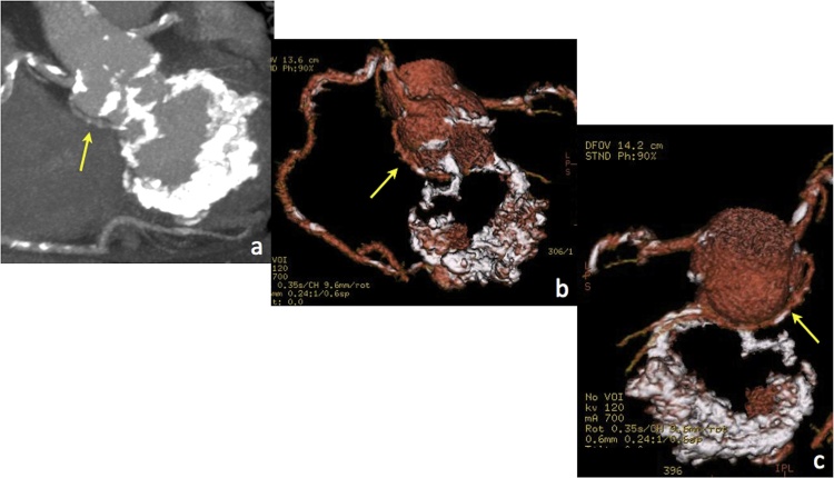 Fig. 10