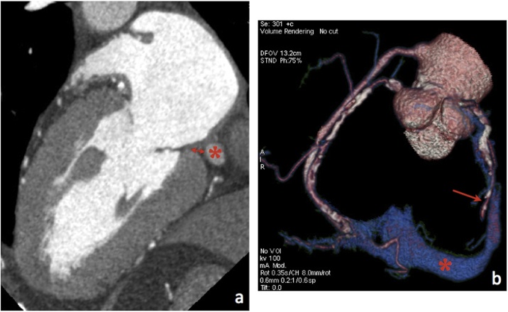 Fig. 11