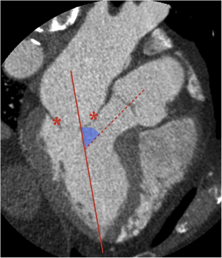 Fig. 12