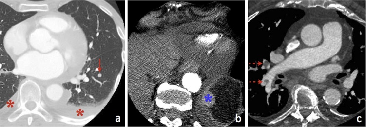 Fig. 13