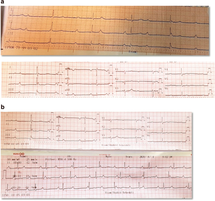 Fig. 2