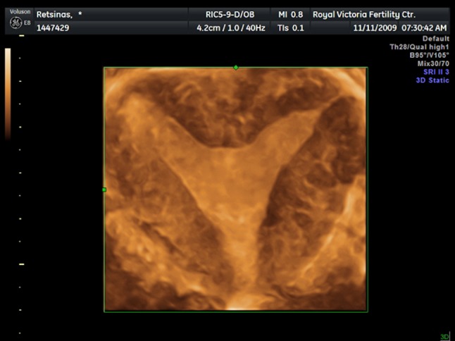 Fig. 3