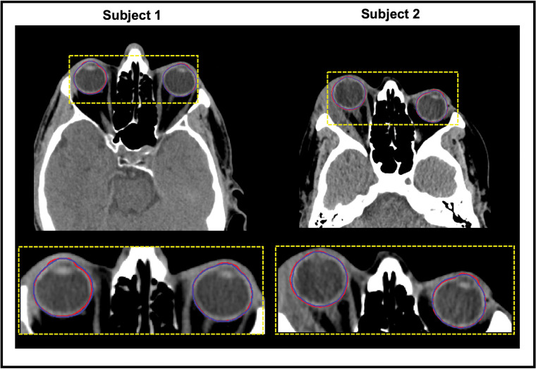 Fig 4.