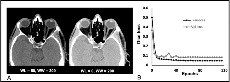 Fig 3.