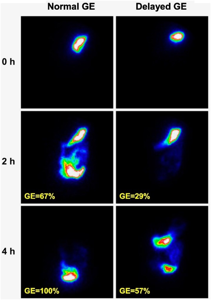 Fig. 12