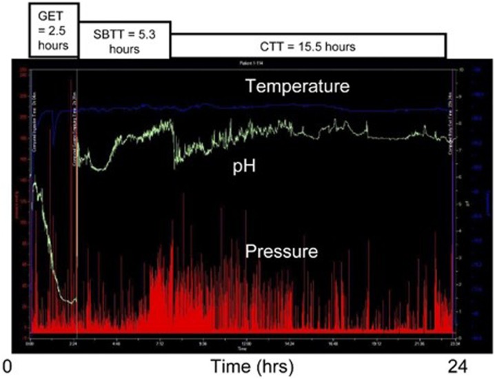 Fig. 13