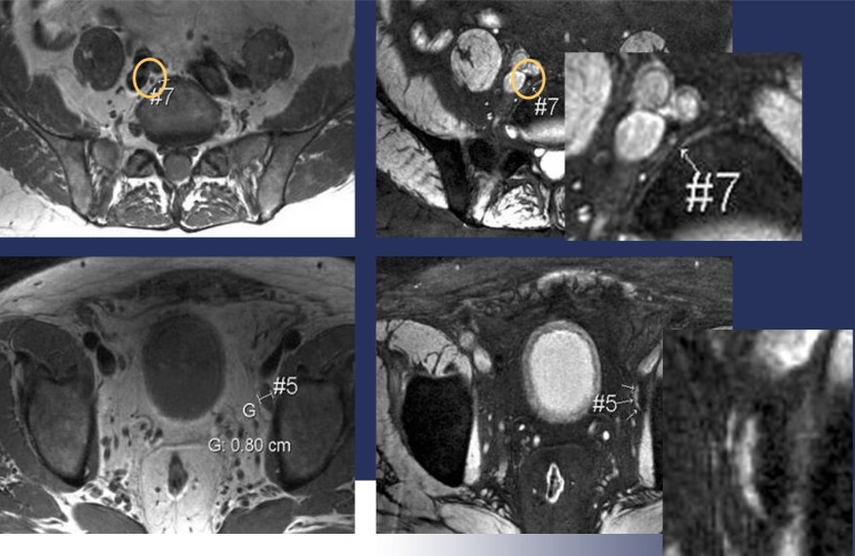 Fig. (5)