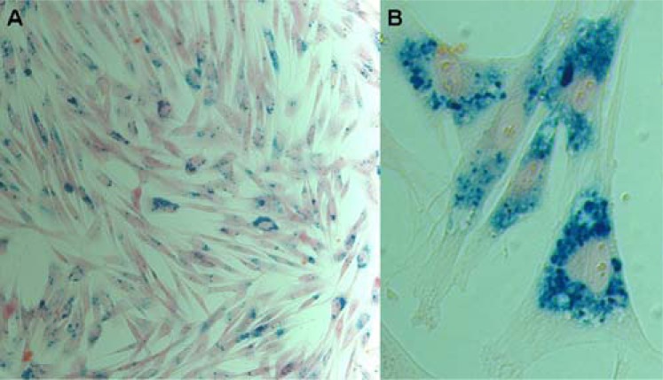 Fig. (3)