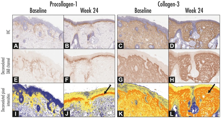 Fig. 3