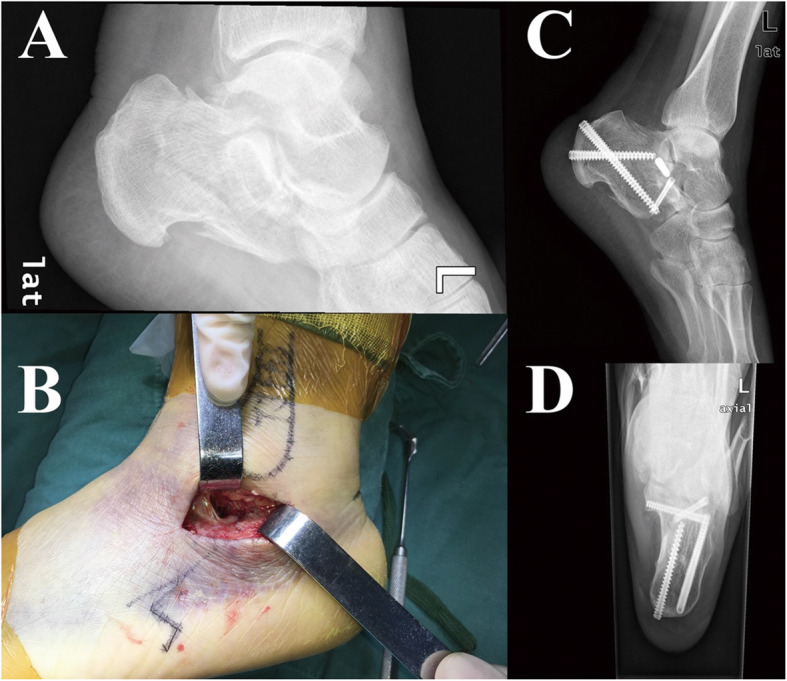 Fig. 2