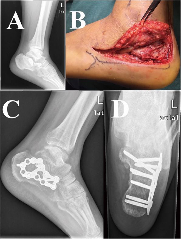 Fig.1