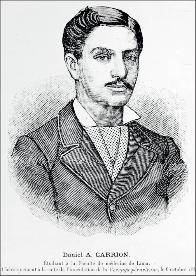 Fig 2.