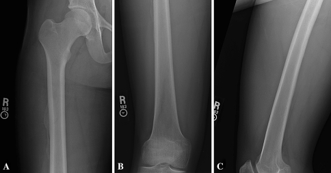 Fig. 5A–C