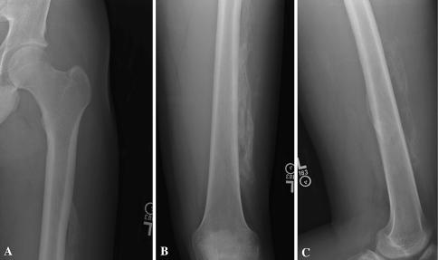 Fig. 4A–C