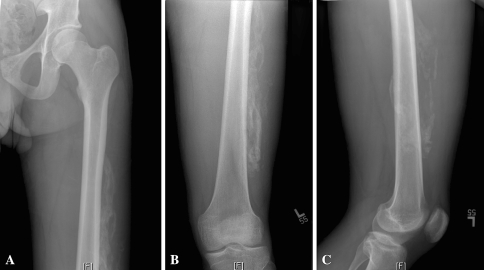 Fig. 1A–C