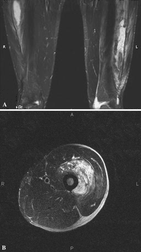 Fig. 3A–B