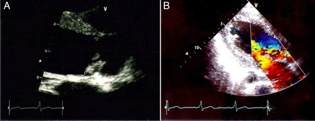 Figure 2