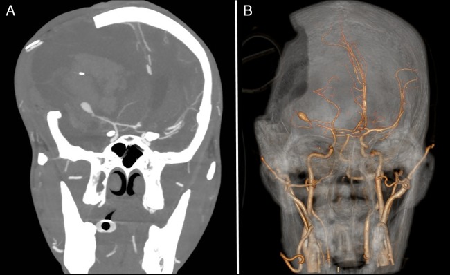 Figure 5