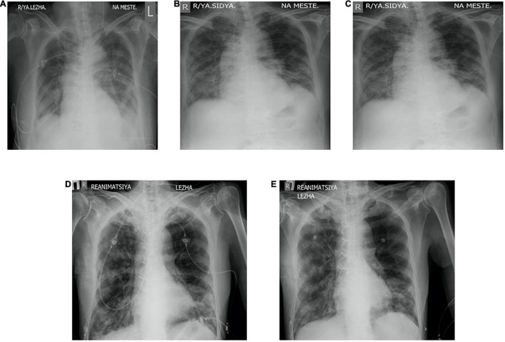 FIGURE 2