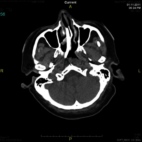 Figure 2