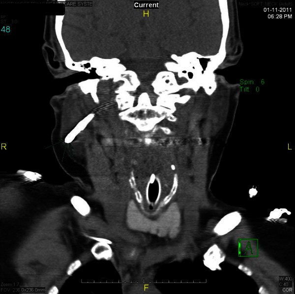 Figure 4