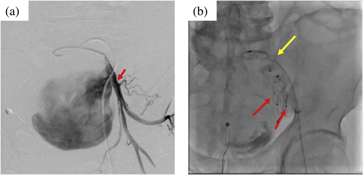 Fig. 2