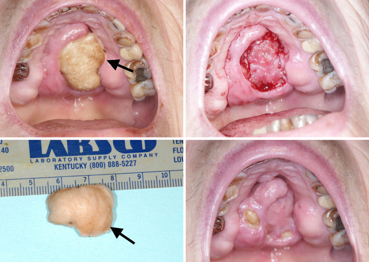 Fig. 1