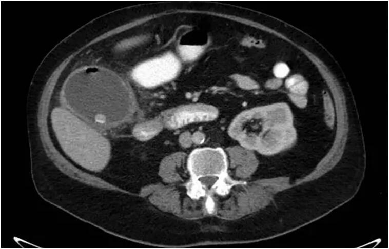 Fig. 2