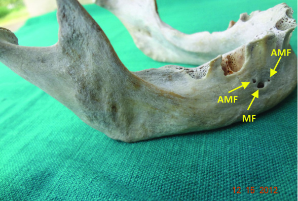 [Table/Fig-3]: