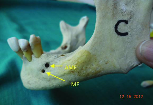 [Table/Fig-4]: