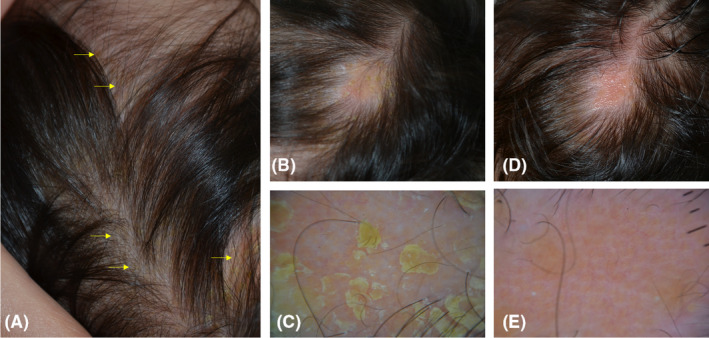 FIGURE 2