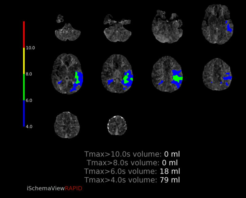 Figure 14