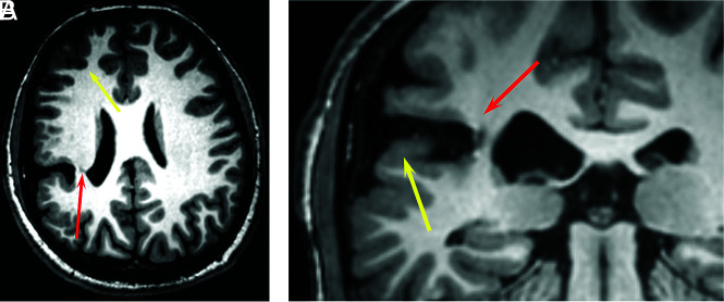 FIG 2.