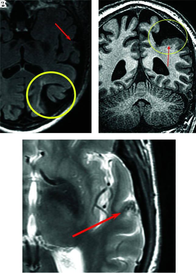 FIG 3.