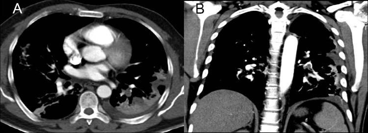 FIG 1