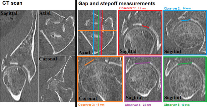 Fig. 2