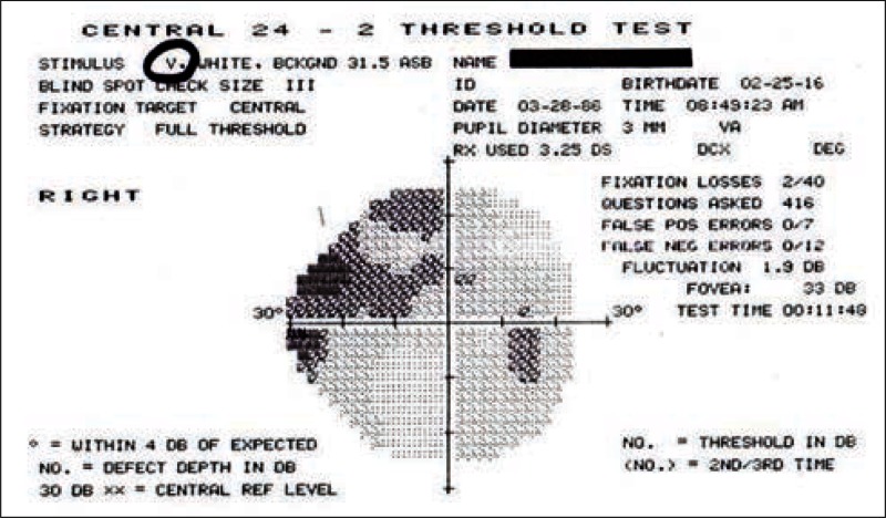 Figure 12b