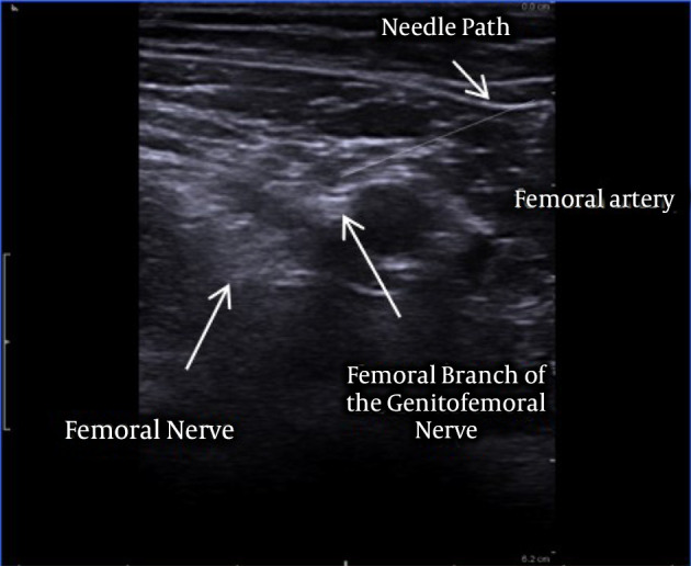 Figure 2.