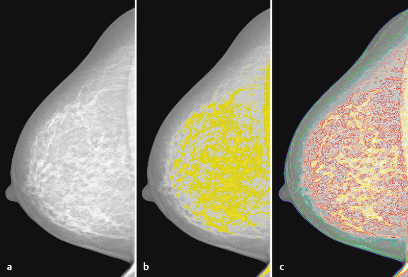 Fig. 1 a