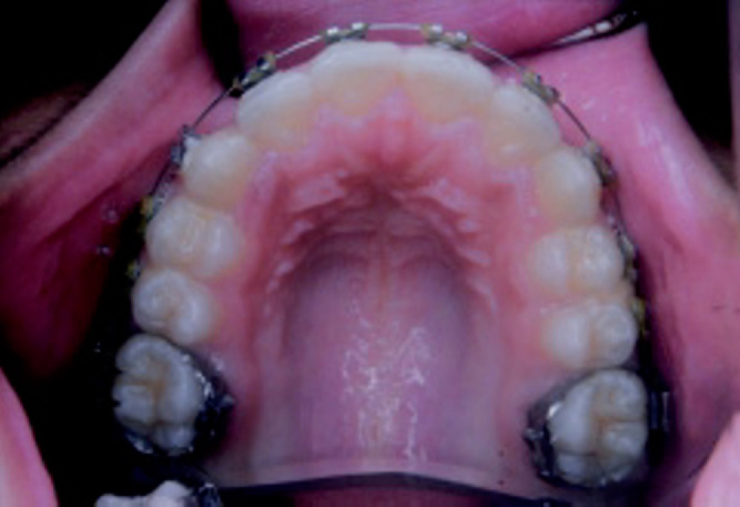 Fig. 4