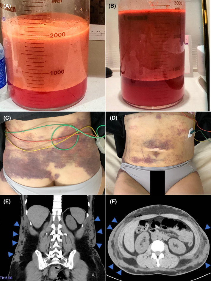 Fig. 1