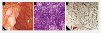 Fig. 1 a