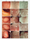 Fig. 2