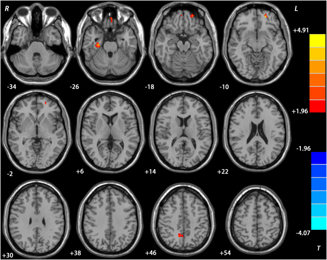 Fig. 2