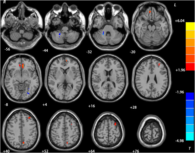 Fig. 3