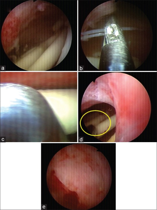 Figure 5